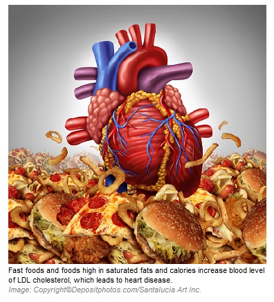 High cholesterol 1 Canadian Academy of Sports Nutrition caasn