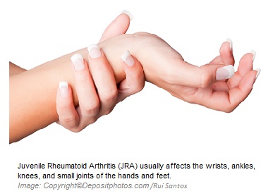 Juvenile Rheumatoid Arthritis 1 Canadian Academy of Sports Nutrition caasn