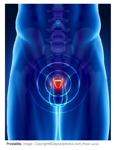 Prostatitis 1 Canadian Academy of Sports Nutrition caasn